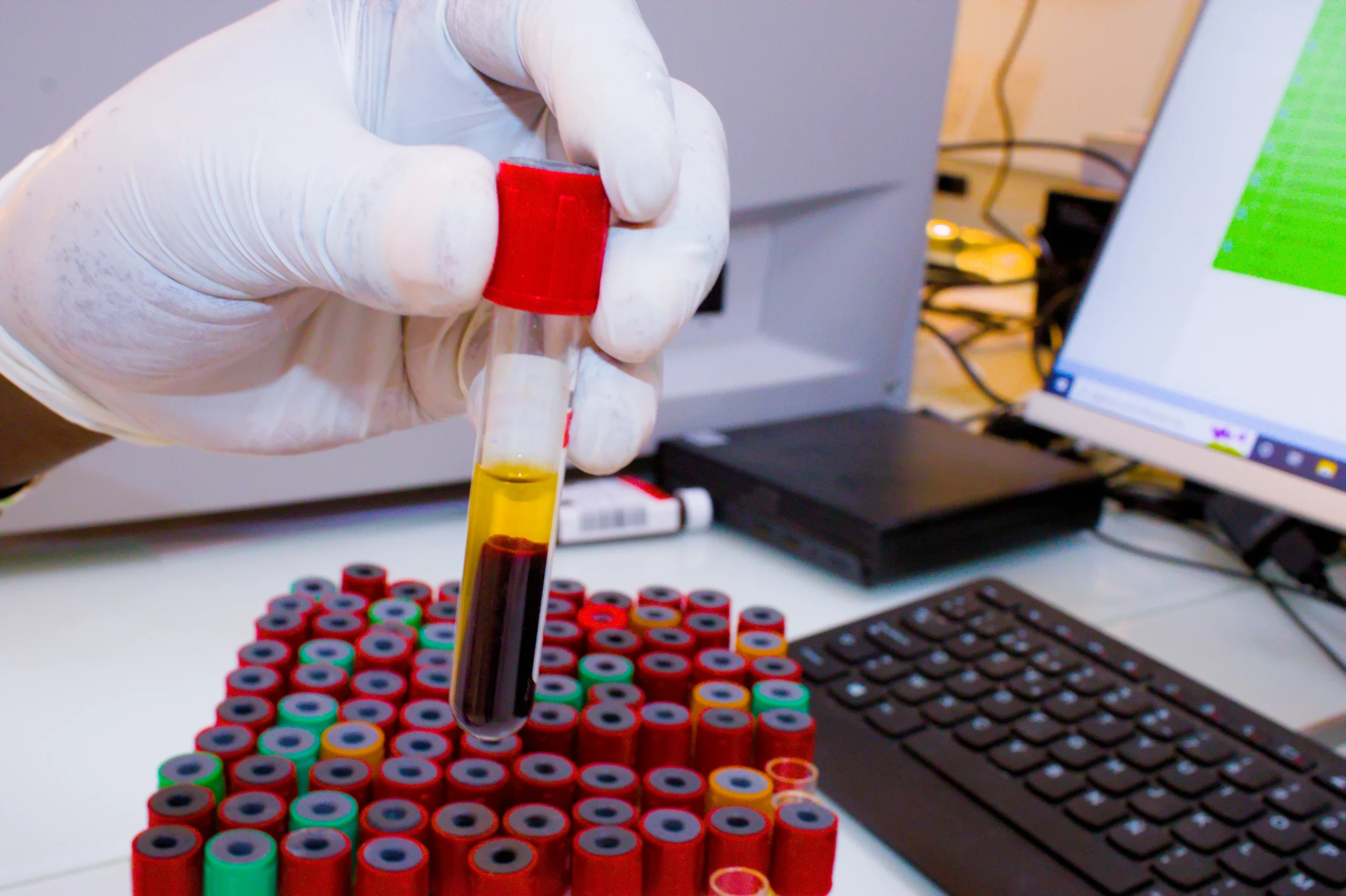 Analyse bio